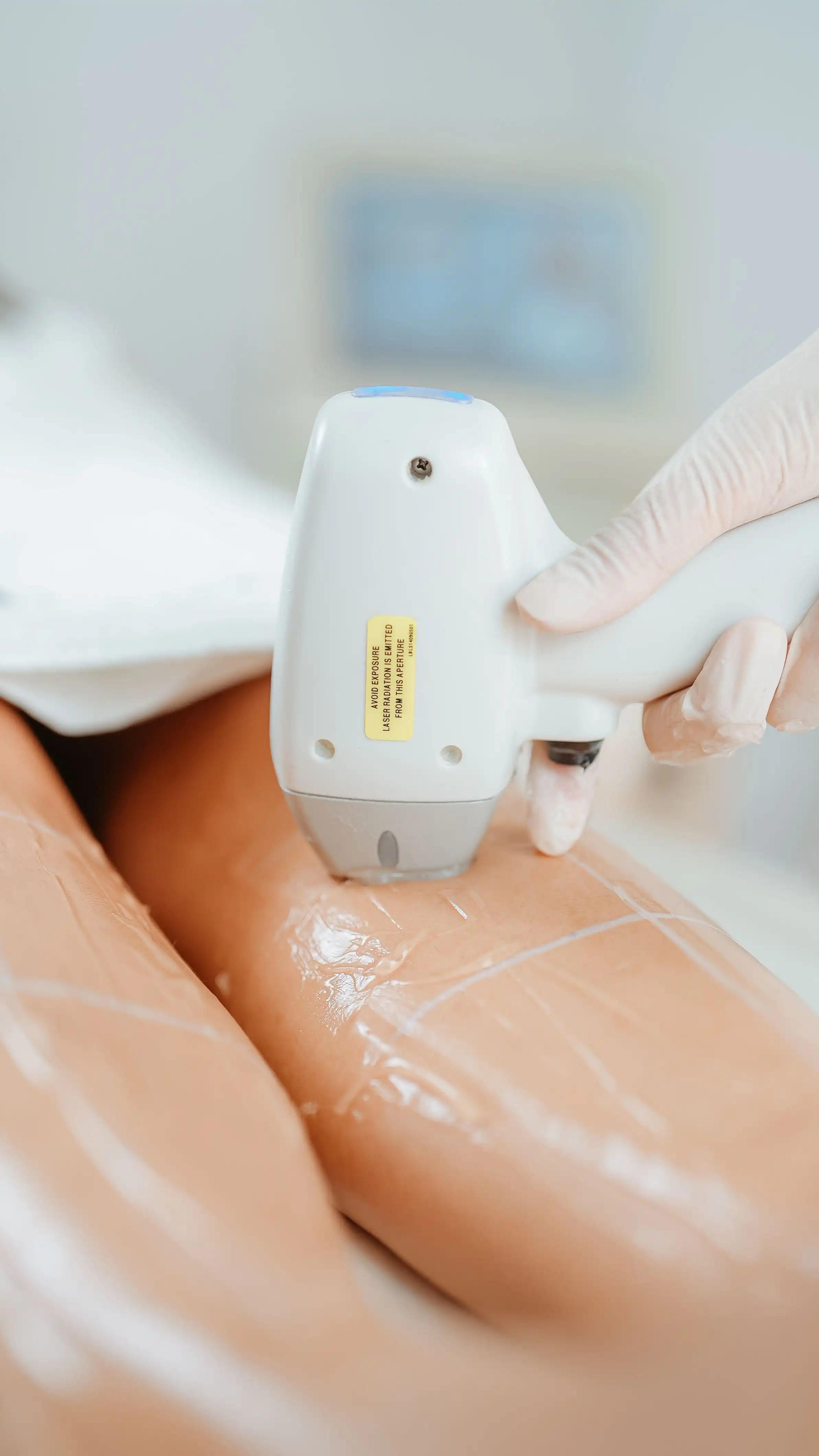 Cursus Laserontharing